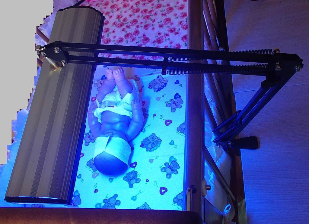 УФ лампа от желтушки для новорожденного. Лампа от желтушки для новорожденного Philips. Ультрафиолетовая лампа для новорожденных от желтушки. Фототерапия от желтушки для новорожденного.