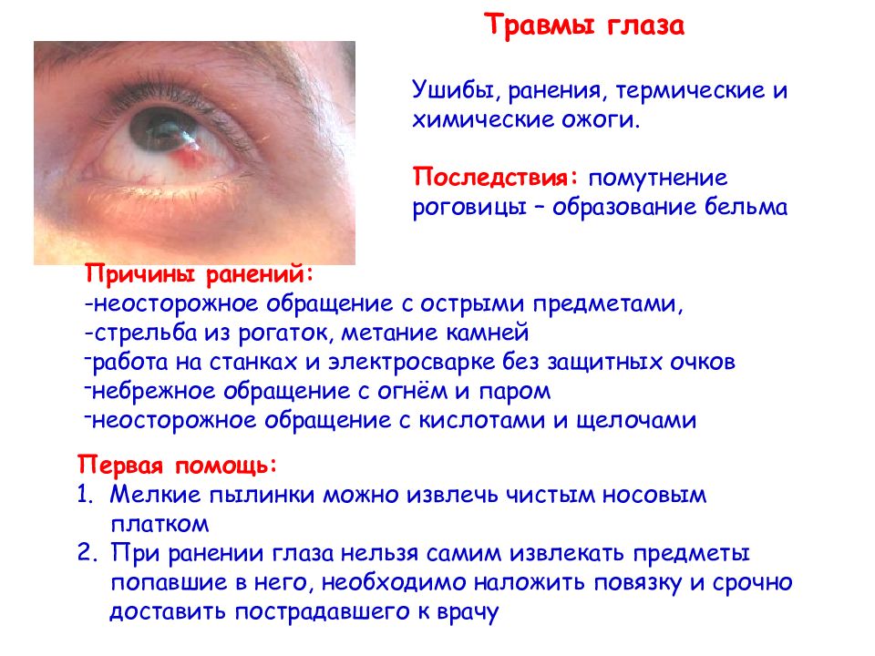 Особенности лечения и опасность ожога глаз ультрафиолетовой и кварцевой лампой